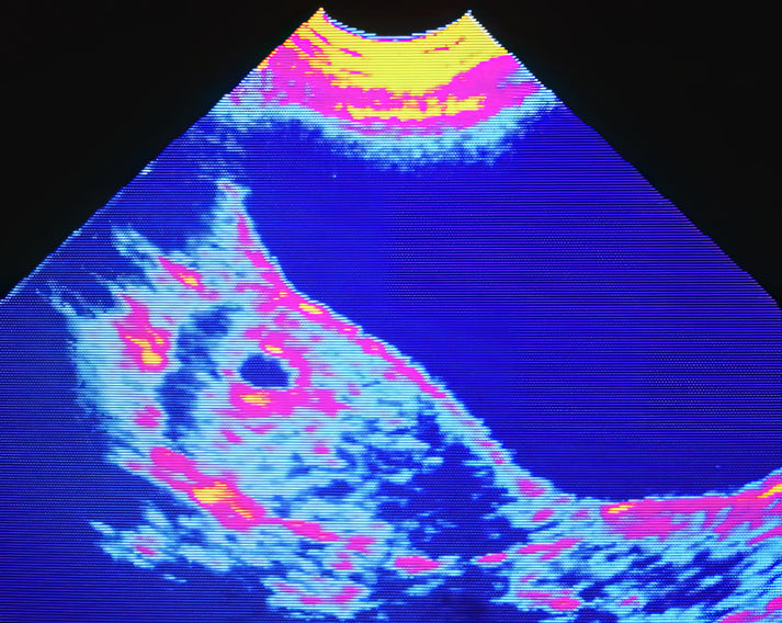 4-6 Week Ultrasound Scan Art Print | Fine Art Print | RedKalion