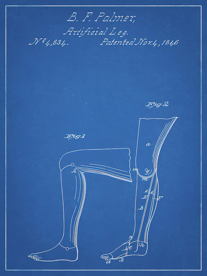 Prosthetic Leg Wall Art Print | Patent Blueprint 1846 | RedKalion