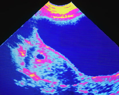 4-6 Week Ultrasound Scan Art Print | Fine Art Print | RedKalion