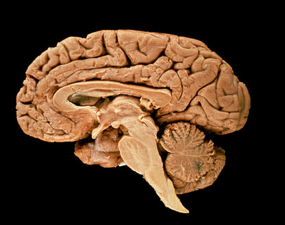 Human Brain Photographs Art Print | RedKalion