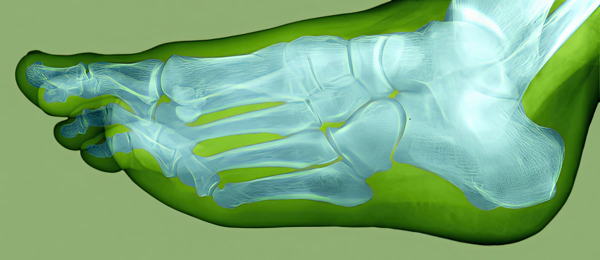 Normal Foot X-Ray Art Print | Museum-Quality Medical Illustration | RedKalion