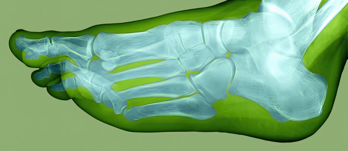 Normal Foot X-Ray Art Print | Museum-Quality Medical Illustration | RedKalion