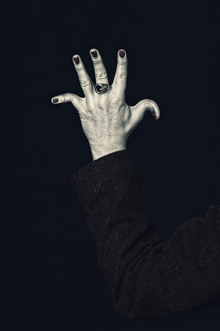 Pictures of Broken Little Finger Art Print | RedKalion