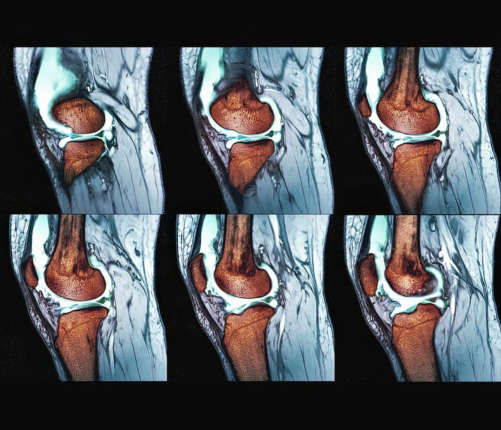 Real Sprained Knee Pictures Art Print | Museum-Quality Medical Illustration | RedKalion