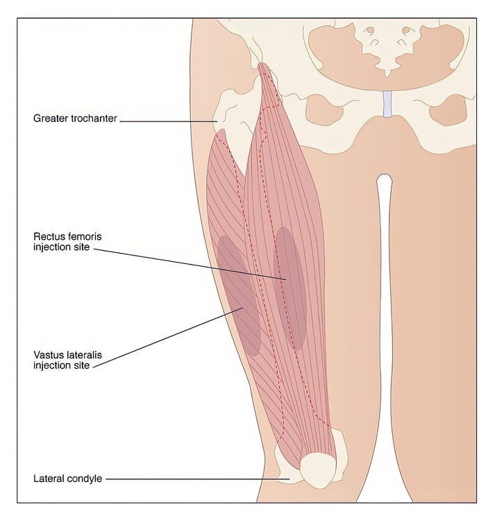 Vastus Lateralis Injection Site Art Print | Medical Artwork | RedKalion